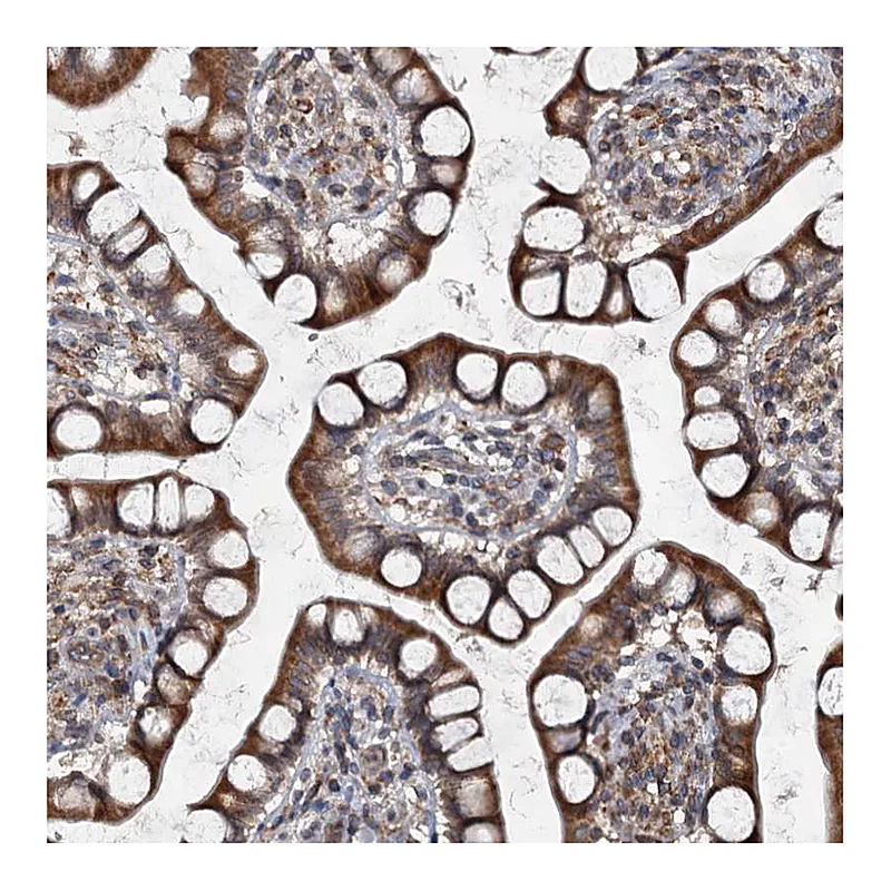 Atlas Antibodies Anti-TAPBPL Antibody