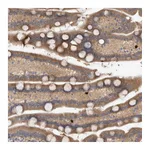 Atlas Antibodies Anti-TARBP1 Antibody