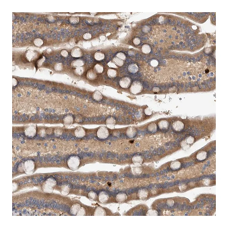 Atlas Antibodies Anti-TARBP1 Antibody
