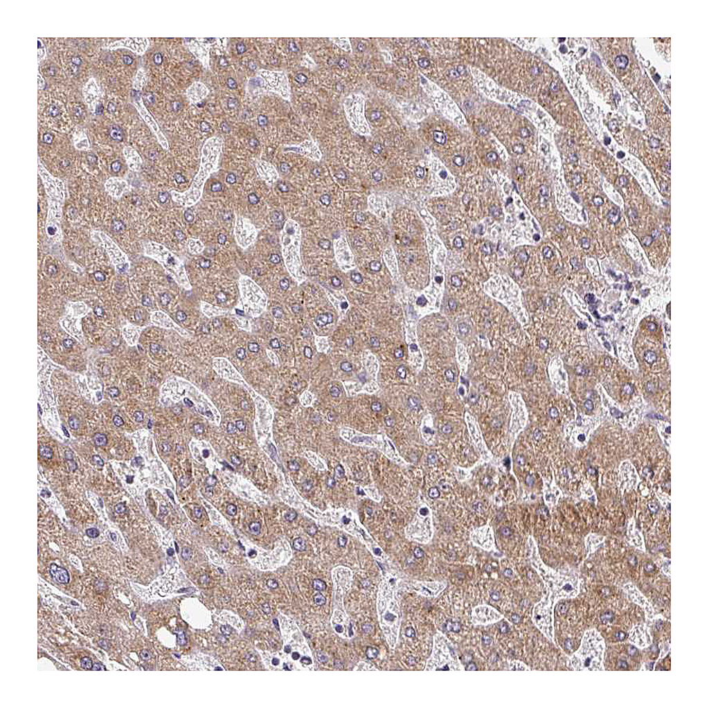 Atlas Antibodies Anti-TAPT1 Antibody