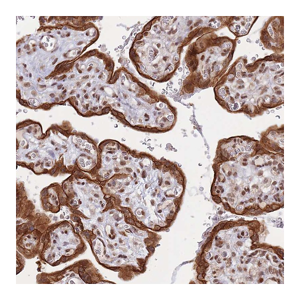 Atlas Antibodies Anti-TARBP2 Antibody