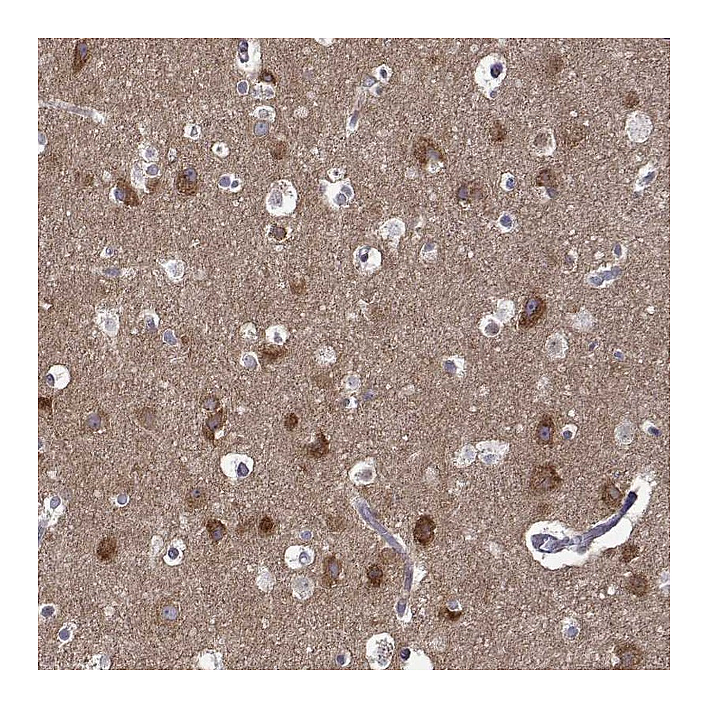 Atlas Antibodies Anti-TARBP2 Antibody