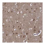 Atlas Antibodies Anti-TARBP2 Antibody