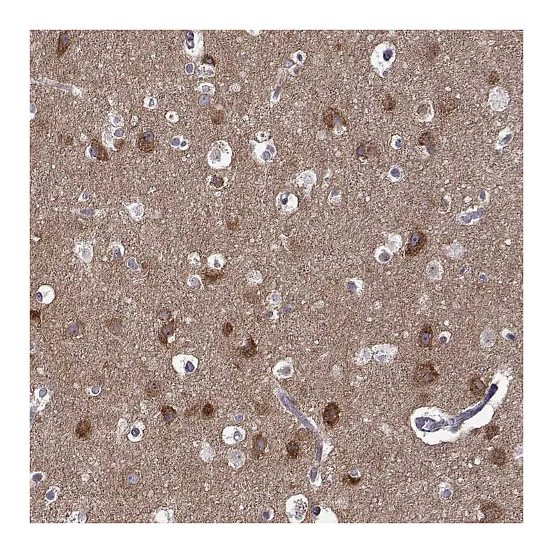 Atlas Antibodies Anti-TARBP2 Antibody