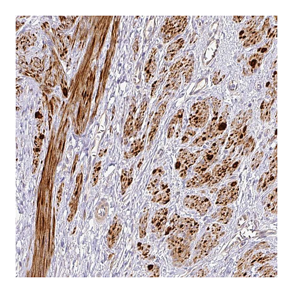 Atlas Antibodies Anti-TARM1 Antibody