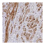 Atlas Antibodies Anti-TARM1 Antibody