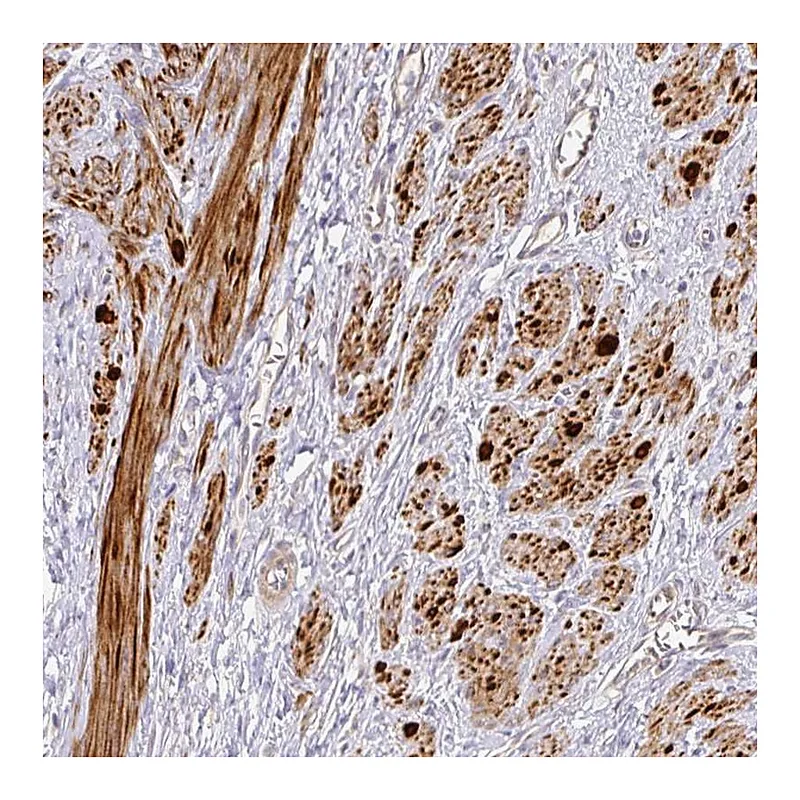 Atlas Antibodies Anti-TARM1 Antibody