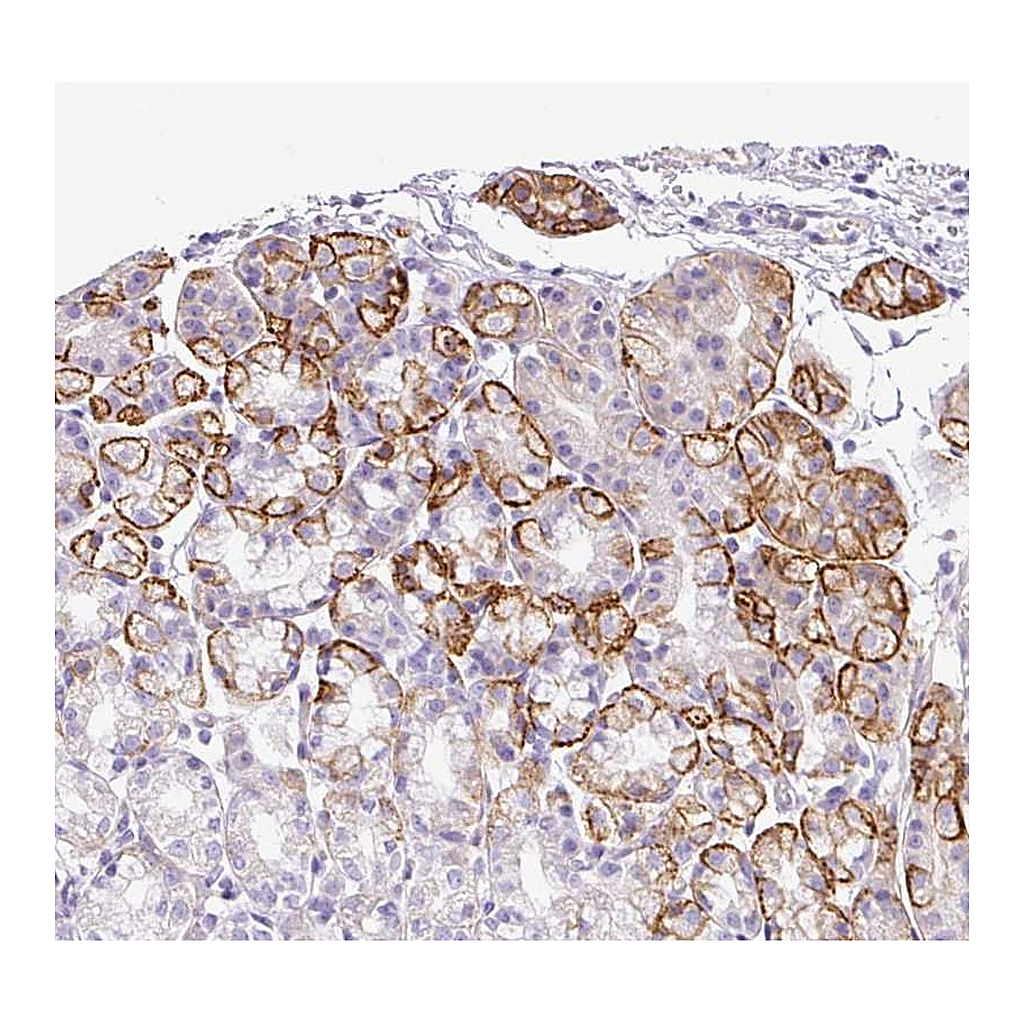 Atlas Antibodies Anti-TARM1 Antibody