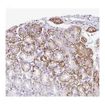 Atlas Antibodies Anti-TARM1 Antibody