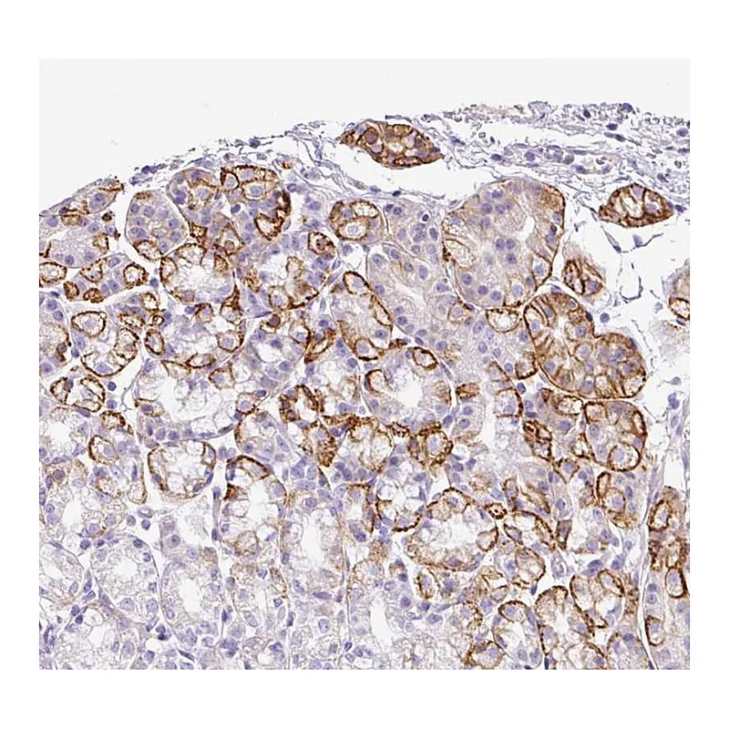 Atlas Antibodies Anti-TARM1 Antibody