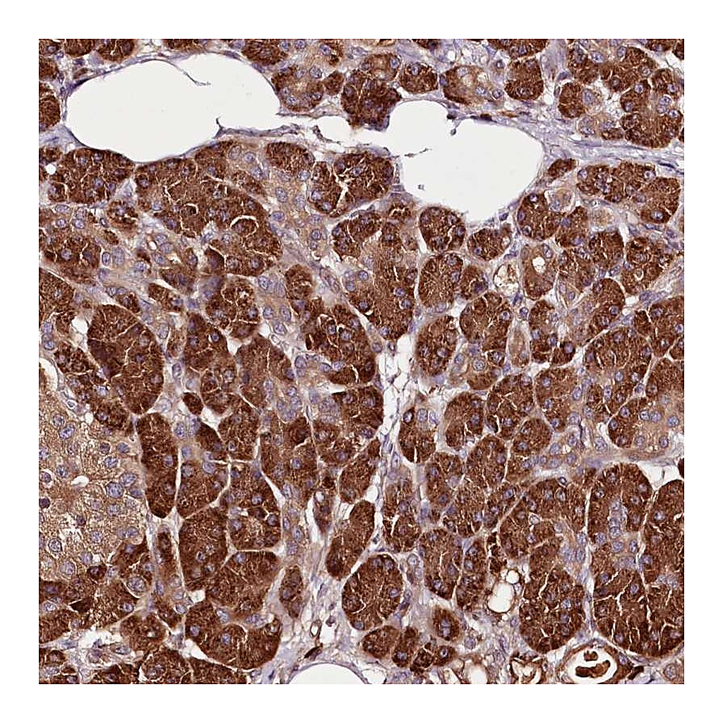 Atlas Antibodies Anti-TARS Antibody