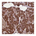 Atlas Antibodies Anti-TARS Antibody