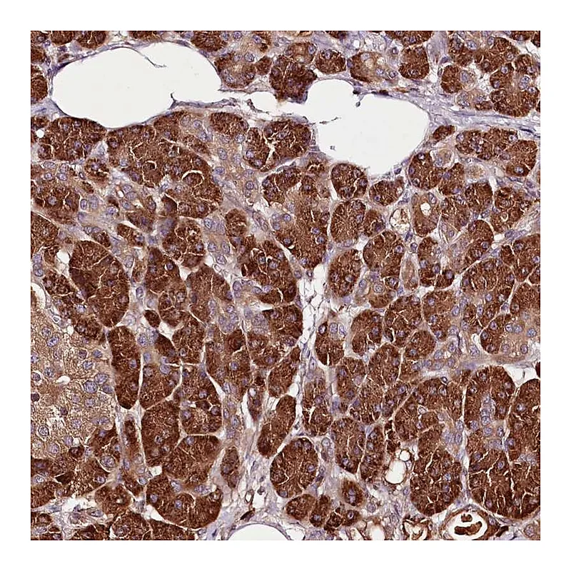 Atlas Antibodies Anti-TARS Antibody