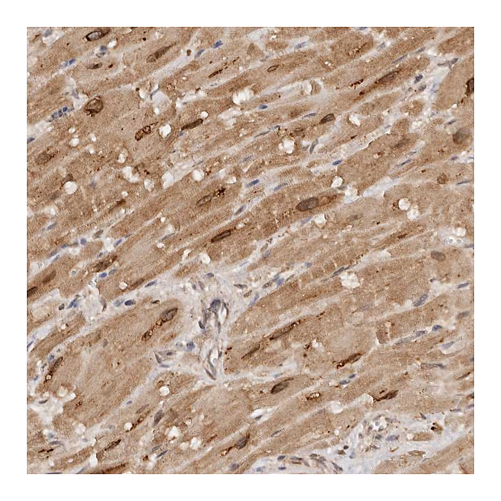 Atlas Antibodies Anti-TARS2 Antibody