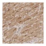 Atlas Antibodies Anti-TARS2 Antibody