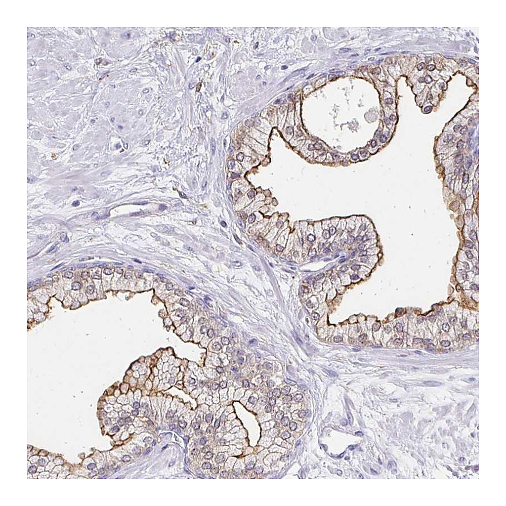 Atlas Antibodies Anti-TAS1R3 Antibody