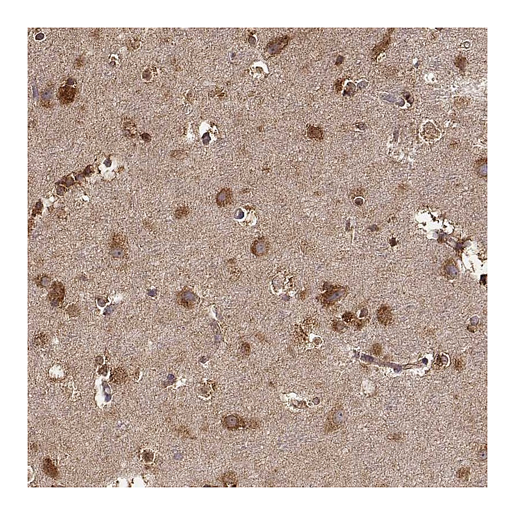 Atlas Antibodies Anti-TARSL2 Antibody
