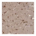 Atlas Antibodies Anti-TARSL2 Antibody