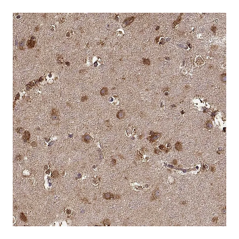 Atlas Antibodies Anti-TARSL2 Antibody