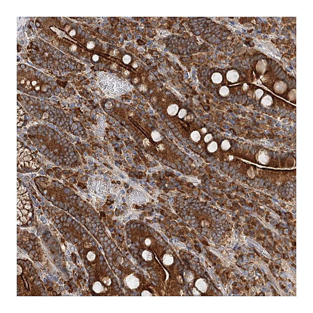Atlas Antibodies Anti-TAS1R1 Antibody