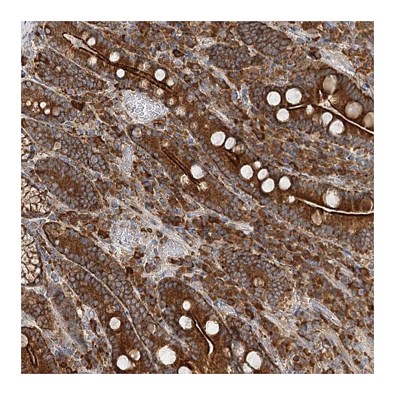 Atlas Antibodies Anti-TAS1R1 Antibody