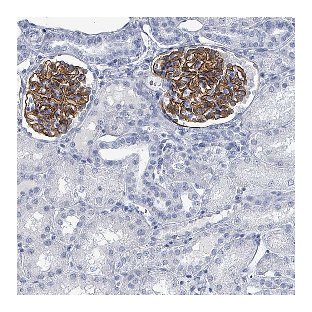Atlas Antibodies Anti-TAS2R1 Antibody