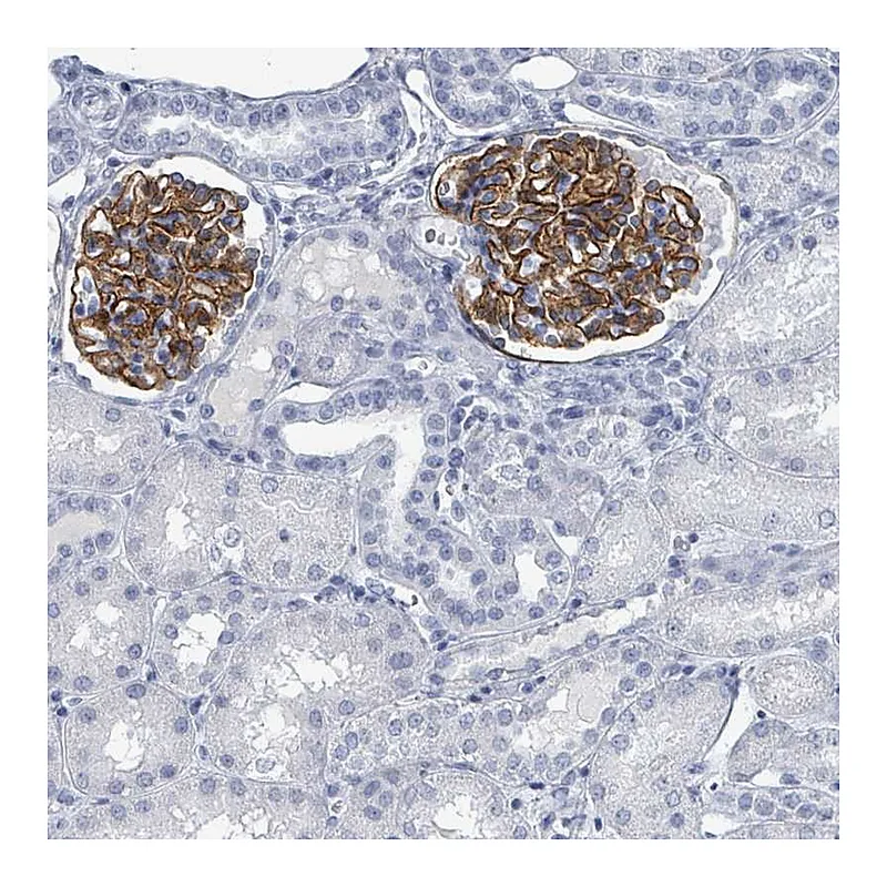 Atlas Antibodies Anti-TAS2R1 Antibody