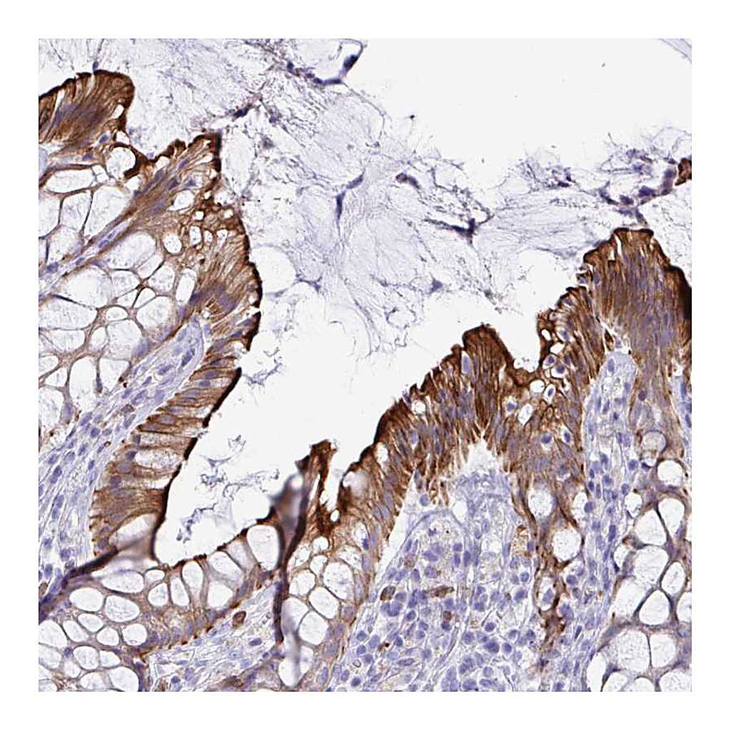 Atlas Antibodies Anti-TAS2R38 Antibody