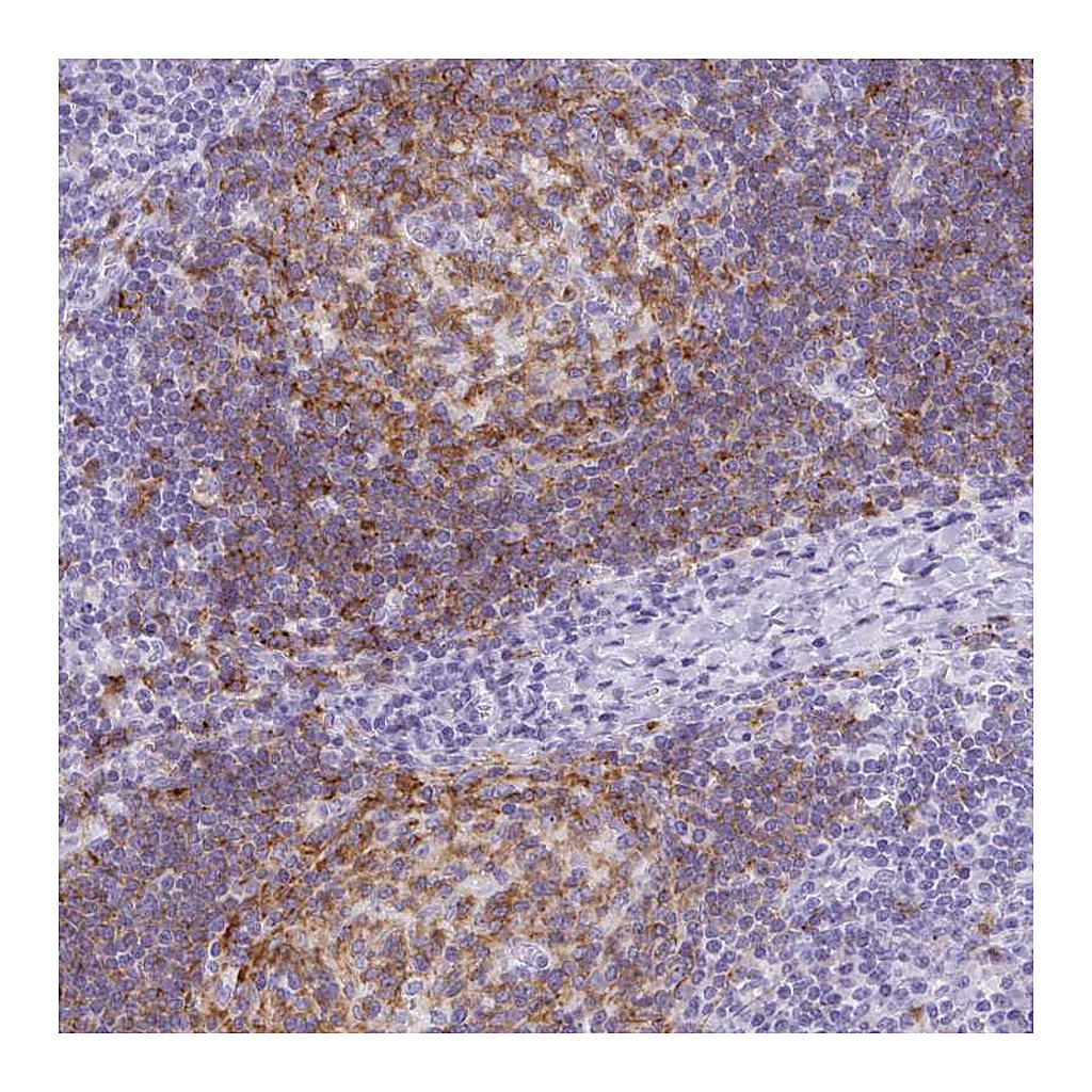 Atlas Antibodies Anti-TAS2R39 Antibody