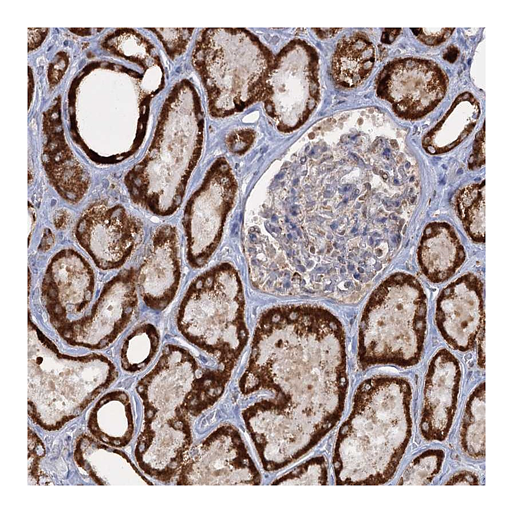 Atlas Antibodies Anti-TAS1R1 Antibody