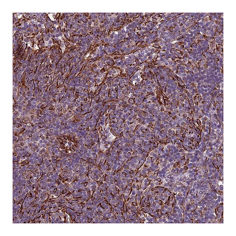 Atlas Antibodies Anti-TAS2R38 Antibody