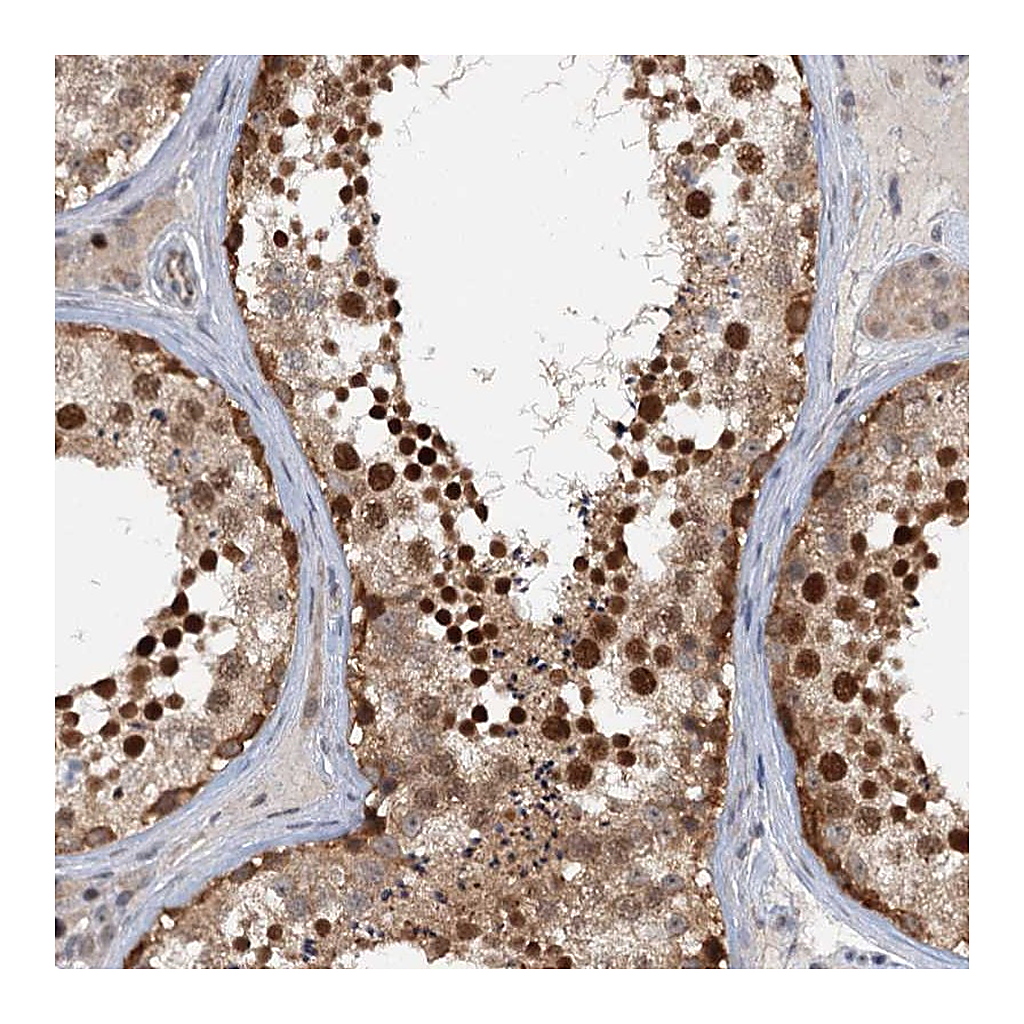 Atlas Antibodies Anti-TAS2R42 Antibody