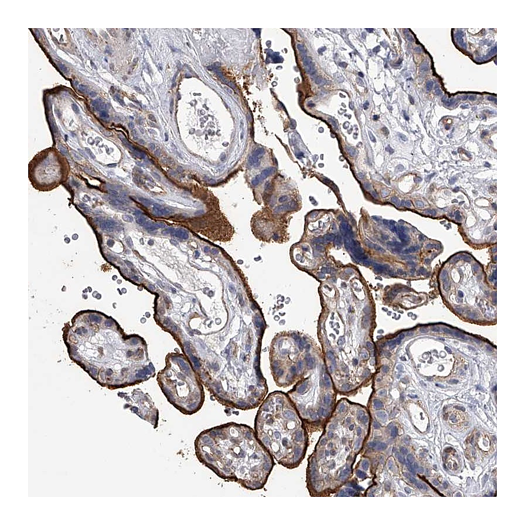 Atlas Antibodies Anti-TASP1 Antibody