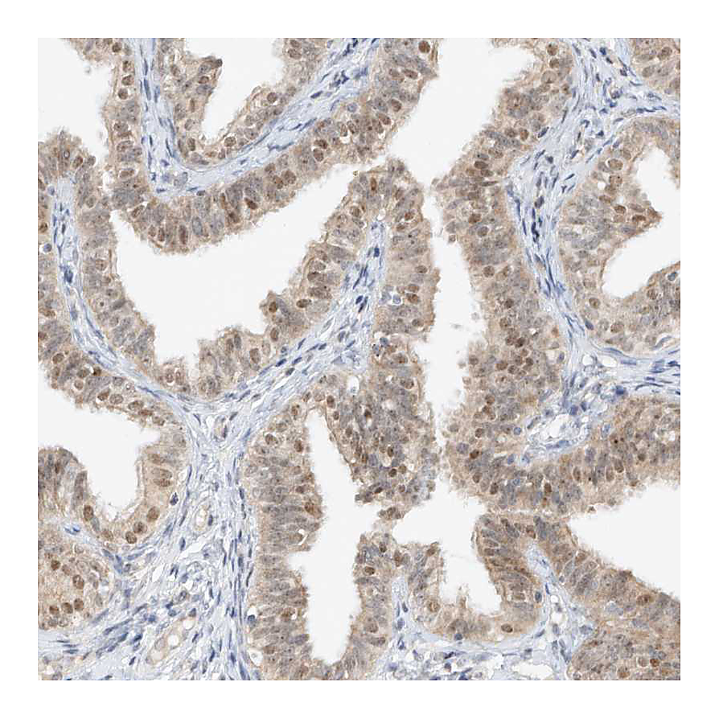 Atlas Antibodies Anti-TASP1 Antibody