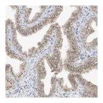 Atlas Antibodies Anti-TASP1 Antibody