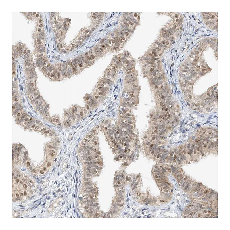 Atlas Antibodies Anti-TASP1 Antibody