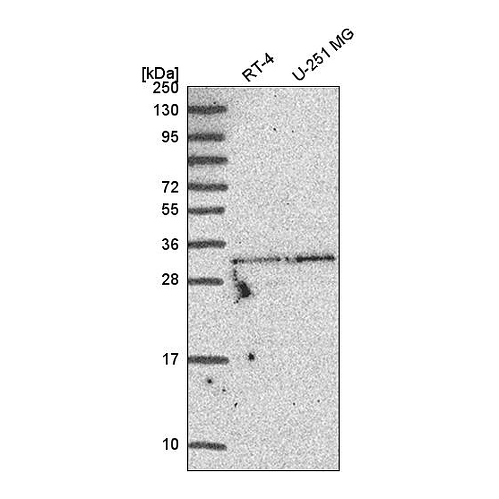 Atlas Antibodies Anti-TATDN1 Antibody