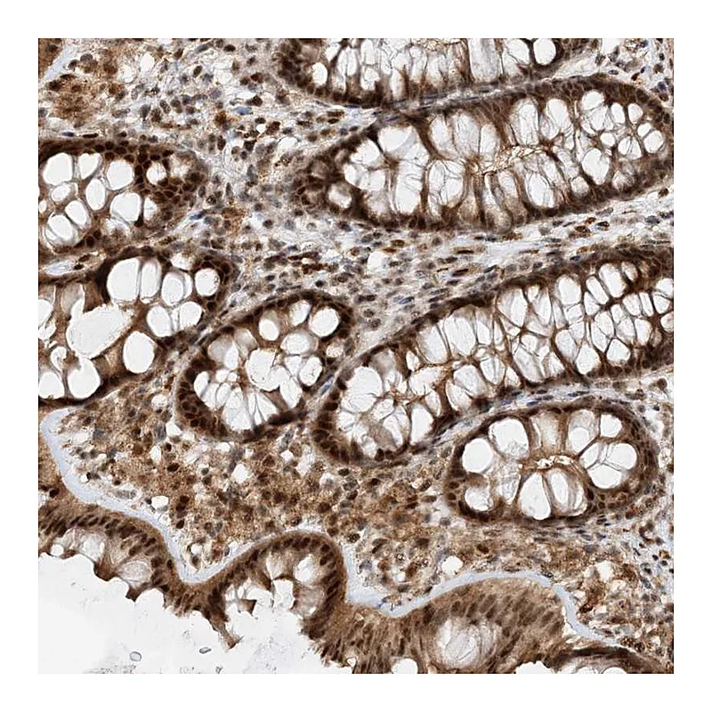 Atlas Antibodies Anti-TATDN3 Antibody