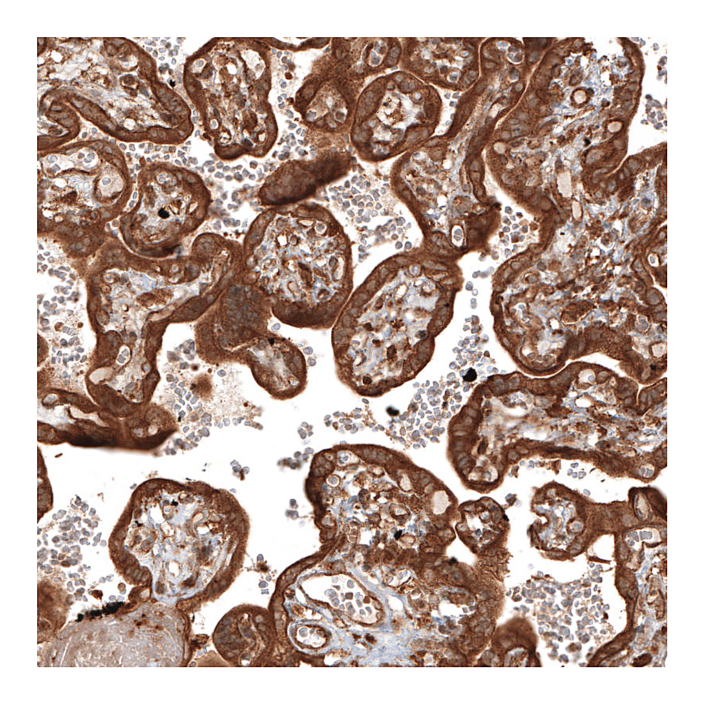 Atlas Antibodies Anti-TAX1BP1 Antibody