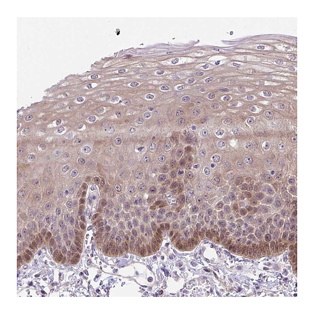 Atlas Antibodies Anti-TAX1BP3 Antibody