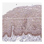 Atlas Antibodies Anti-TAX1BP3 Antibody