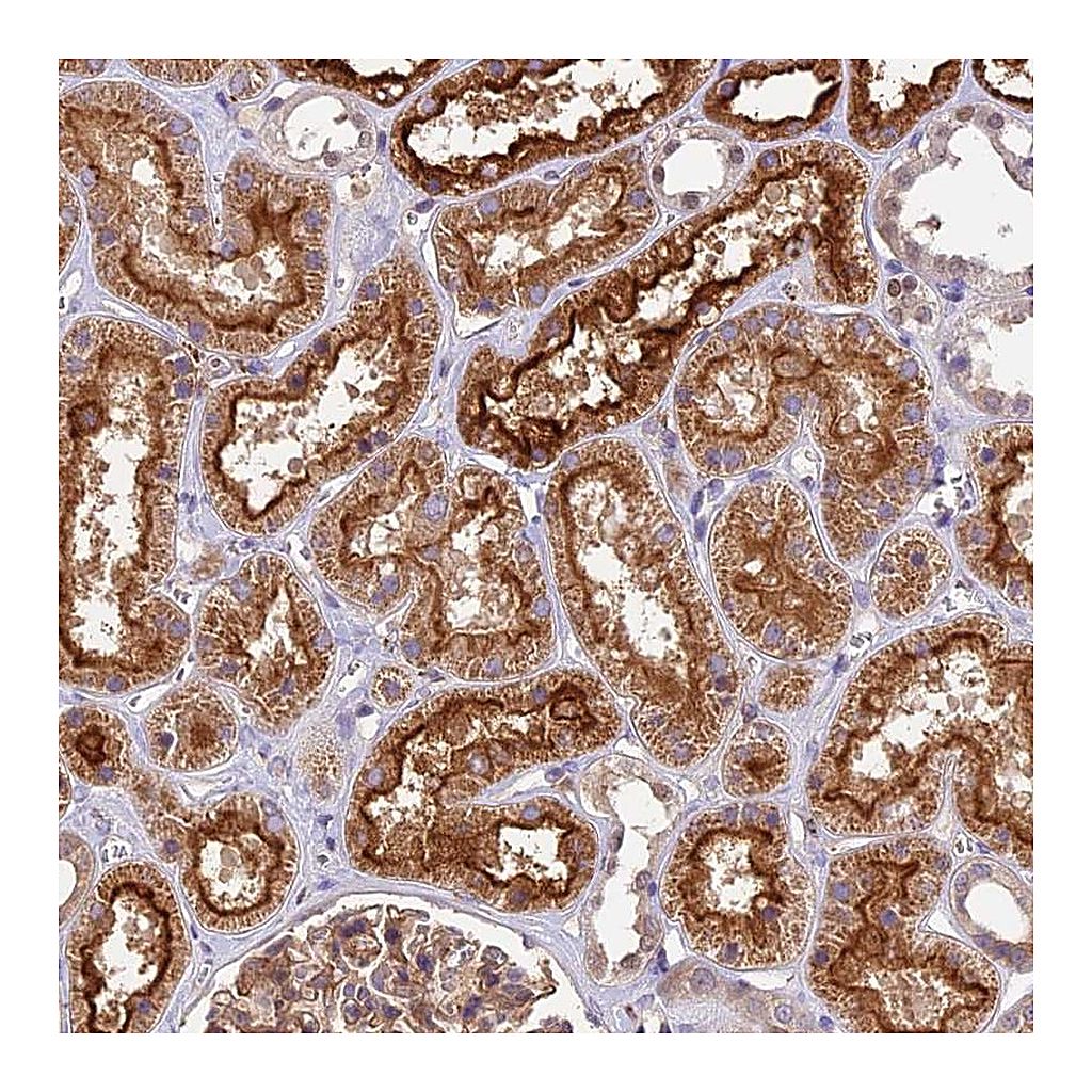 Atlas Antibodies Anti-TBC1D1 Antibody