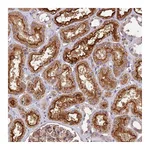Atlas Antibodies Anti-TBC1D1 Antibody