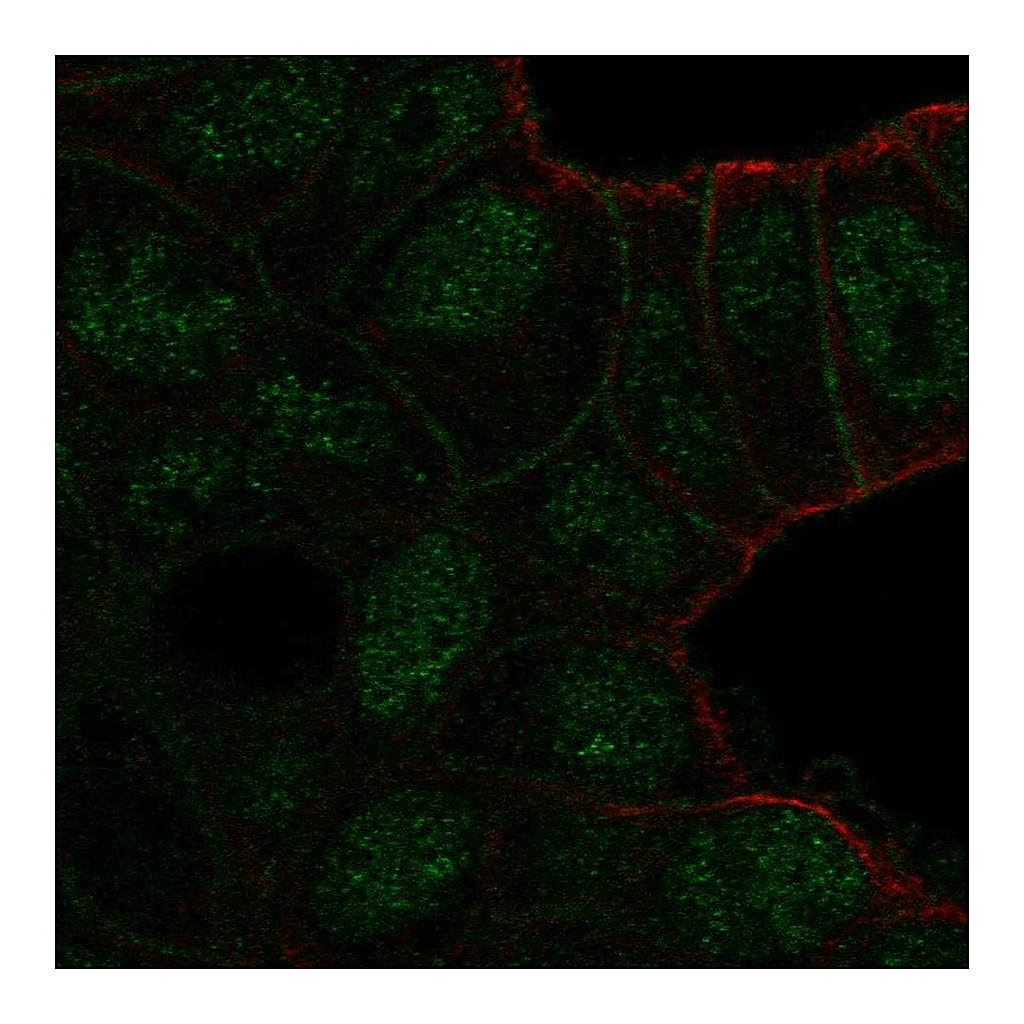 Atlas Antibodies Anti-TBC1D10A Antibody
