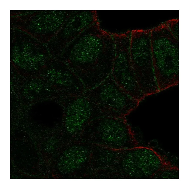 Atlas Antibodies Anti-TBC1D10A Antibody