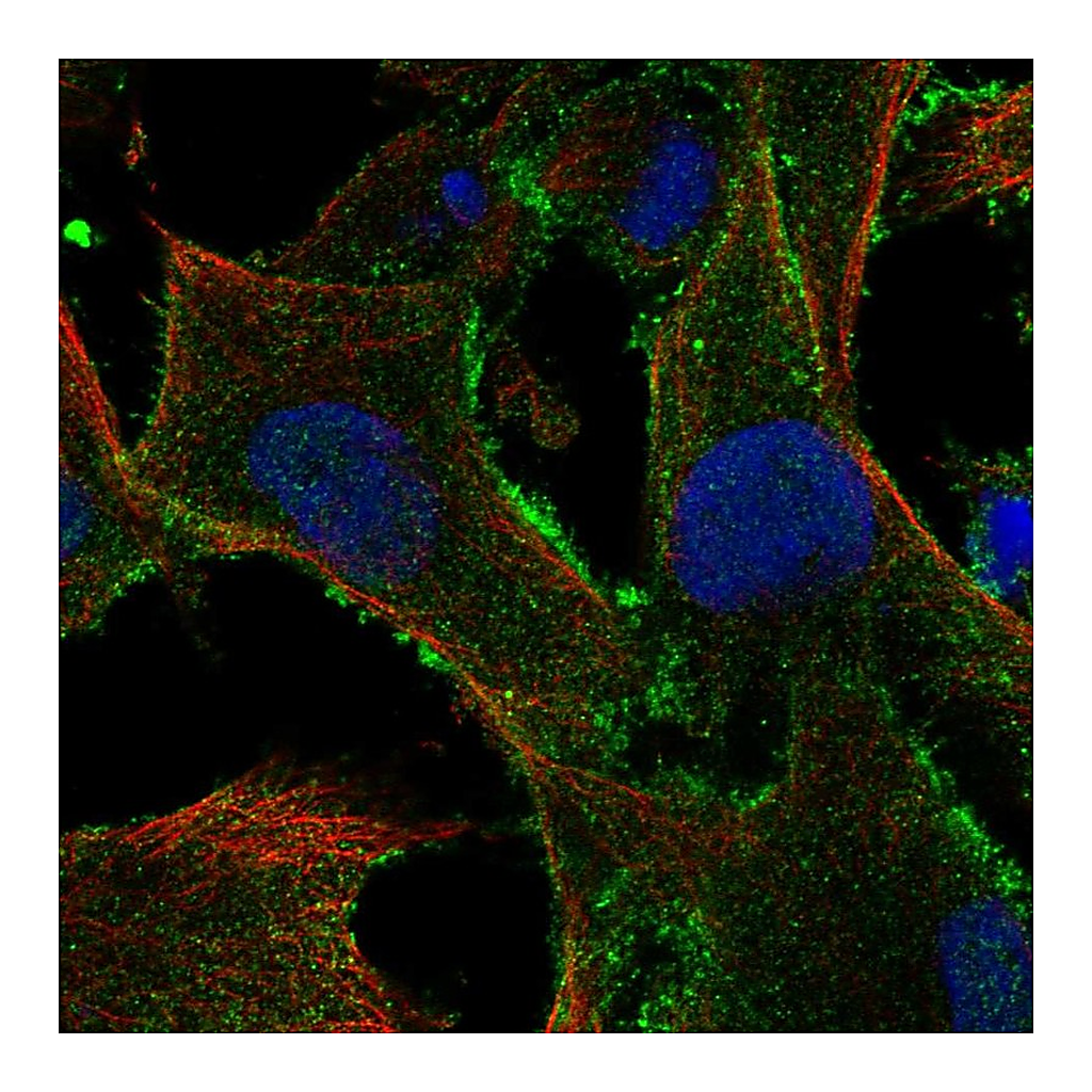Atlas Antibodies Anti-TBC1D10A Antibody