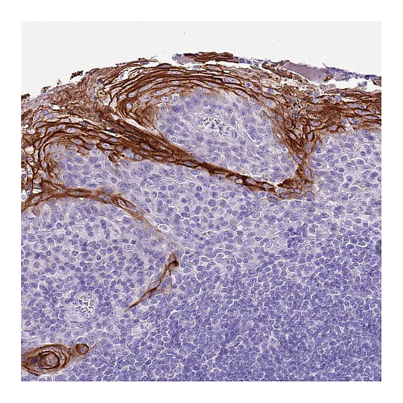 Atlas Antibodies Anti-TBC1D10B Antibody