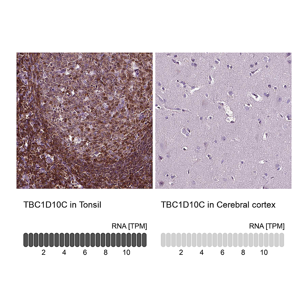 Atlas Antibodies Anti-TBC1D10C Antibody