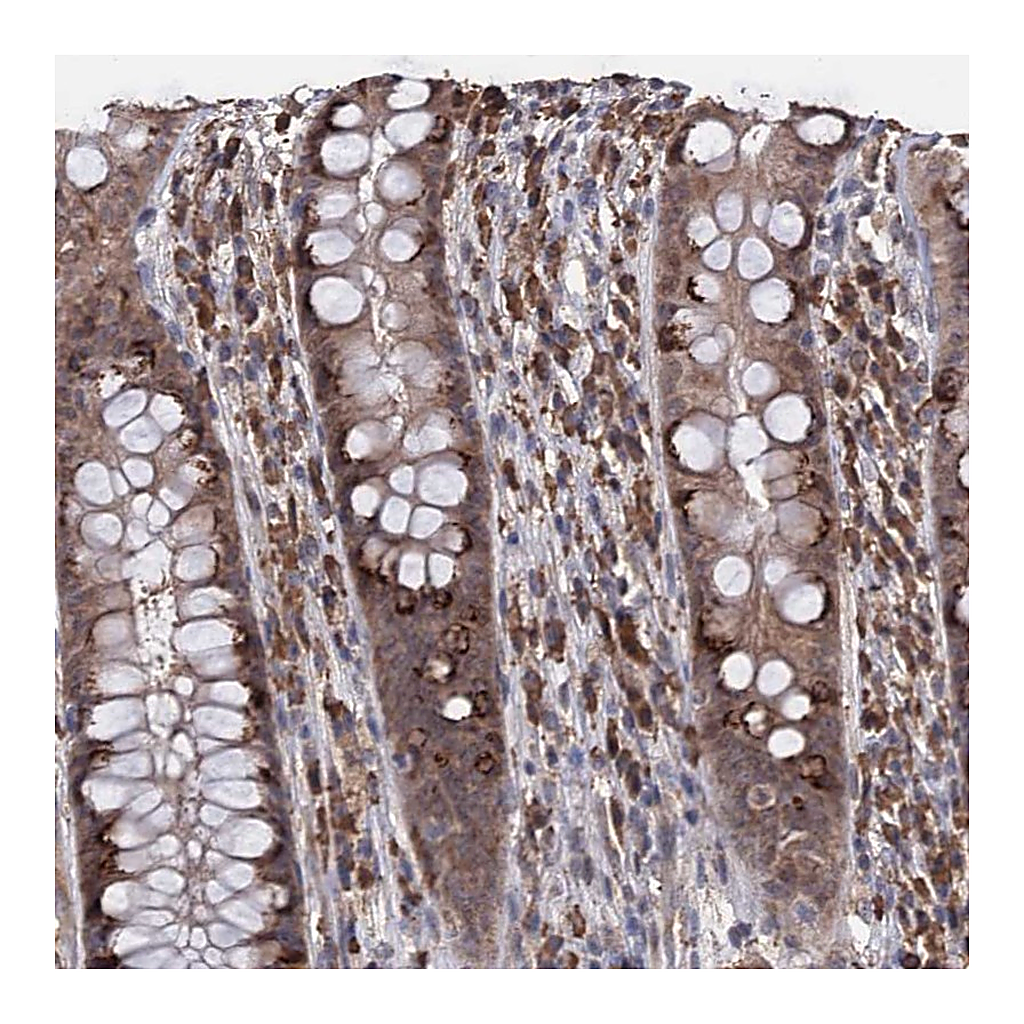 Atlas Antibodies Anti-TBC1D12 Antibody