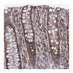 Atlas Antibodies Anti-TBC1D12 Antibody